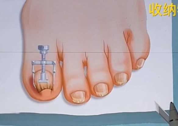 收纳物语芊芊玉足通关攻略_http://www.abetid.com_游戏攻略_第7张